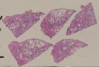 vignette Lame virtuelle : Prostate humaine