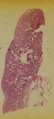 vignette Lame virtuelle : Thyroïde humaine (HE ph Or)