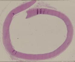 vignette Lame virtuelle : Aorte humaine (HE)