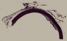 vignette Lame virtuelle : Aorte humaine (TM)