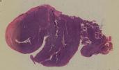 vignette Lame virtuelle :  Amygdale palatine humaine