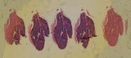 vignette Lame virtuelle de thymus d'enfant