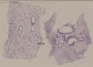 vignette Lame virtuelle : poumon humain (bronche interlobulaire)