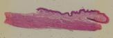 vignette Lame virtuelle : muscle lisse (ex Oesophage humain)